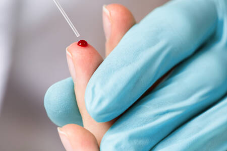 Ein einziger Blutstropfen liefert Gesundheitsdaten in wenigen Minuten
